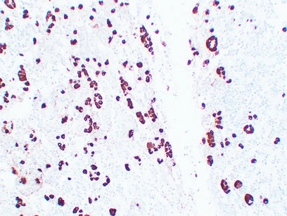 Adrenocorticotropin Mouse Monoclonal Anti-ACTH Antibody