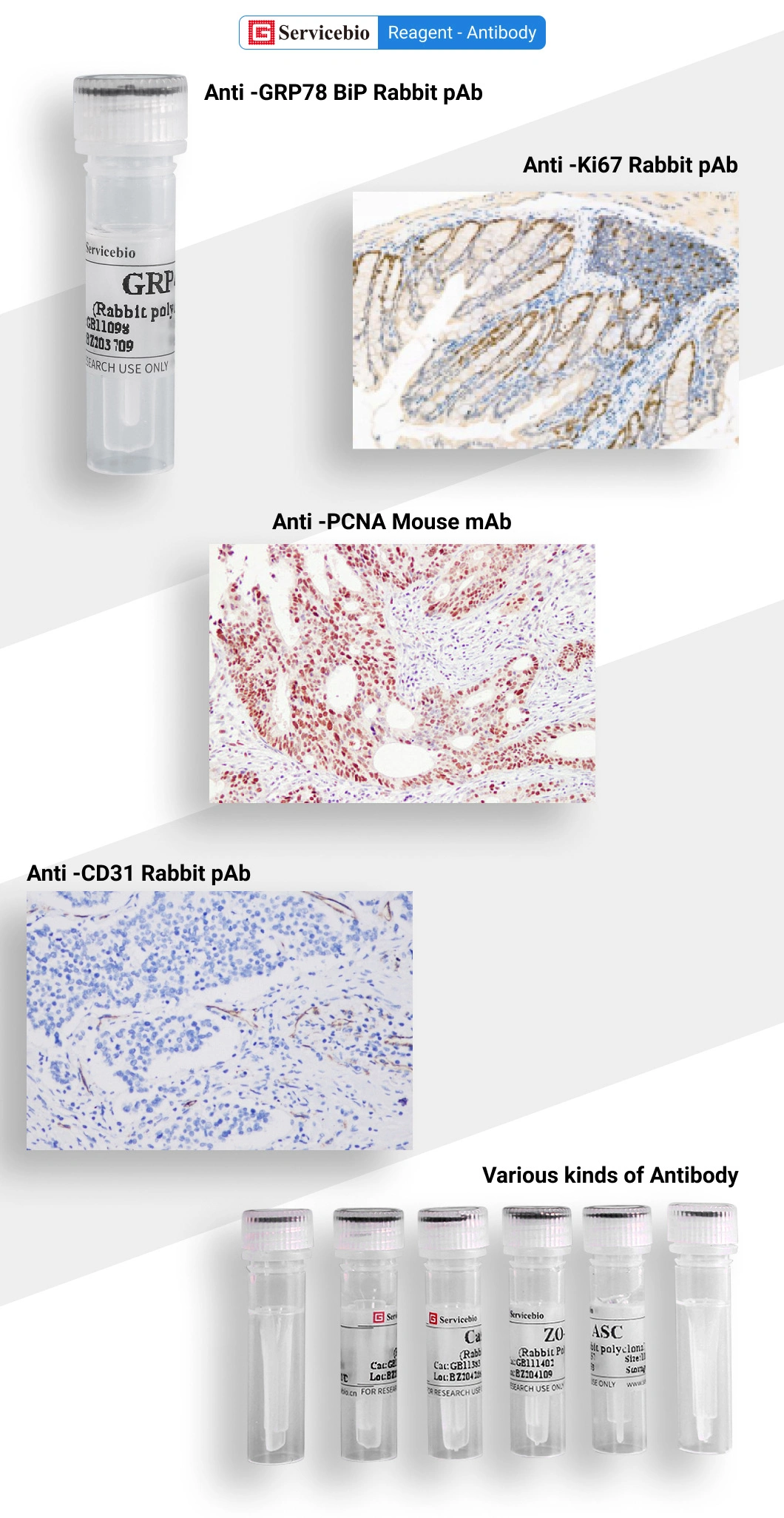 Adrenocorticotropin Mouse Monoclonal Anti-ACTH Antibody