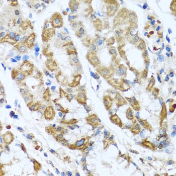 Antxr2 Polyclonal Antibody