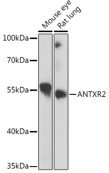 Antxr2 다클론항체